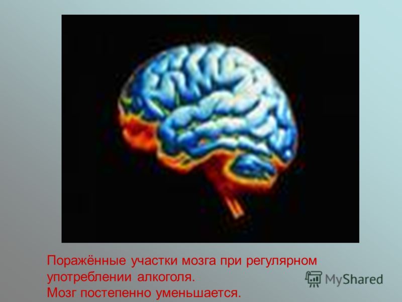 У мужчины болит яичко и отдает в спину