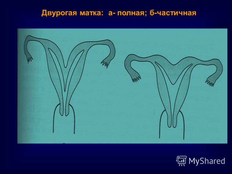 Нежелательная беременность теперь может быть Муж во время беременности: как меняется и что чувствует