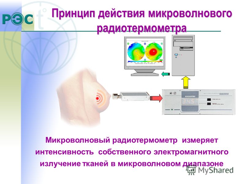 Микроволновый радиотермометр измеряет интенсивность собственного электромагнитного излучение тканей в микроволновом диапазоне Принцип действия микроволнового радиотермометра