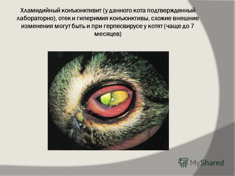 Конъюнктивит Реферат Скачать Конъюнктивит Реферат Скачать