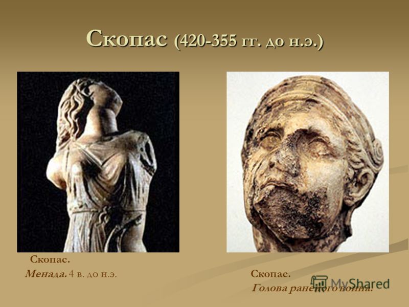 Скопас (420-355 гг. до н.э.) Скопас. Менада. 4 в. до н.э. Скопас. Голова раненого воина.