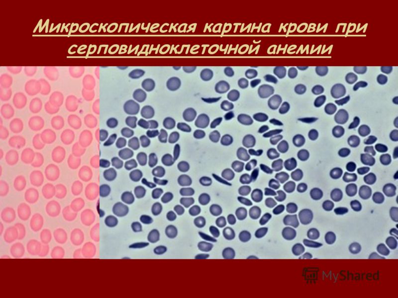 Исторические методы лечения