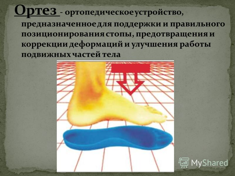 Коррекция формы стопы ортезами (ортопедическими стельками) Укрепленние мышечно-связочного аппарата Оптимизация физических нагрузок Подбор качественной обуви