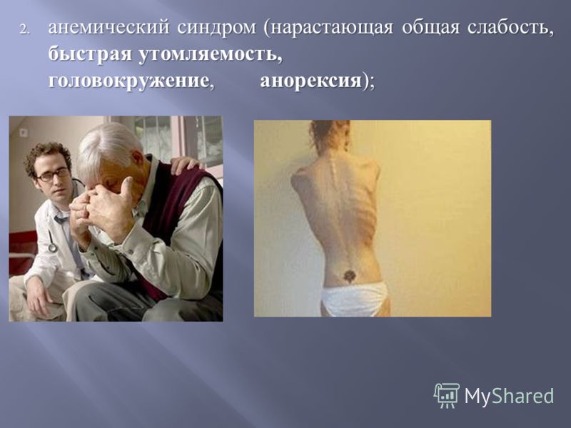 С чем могут быть связаны сильные головокружения 111