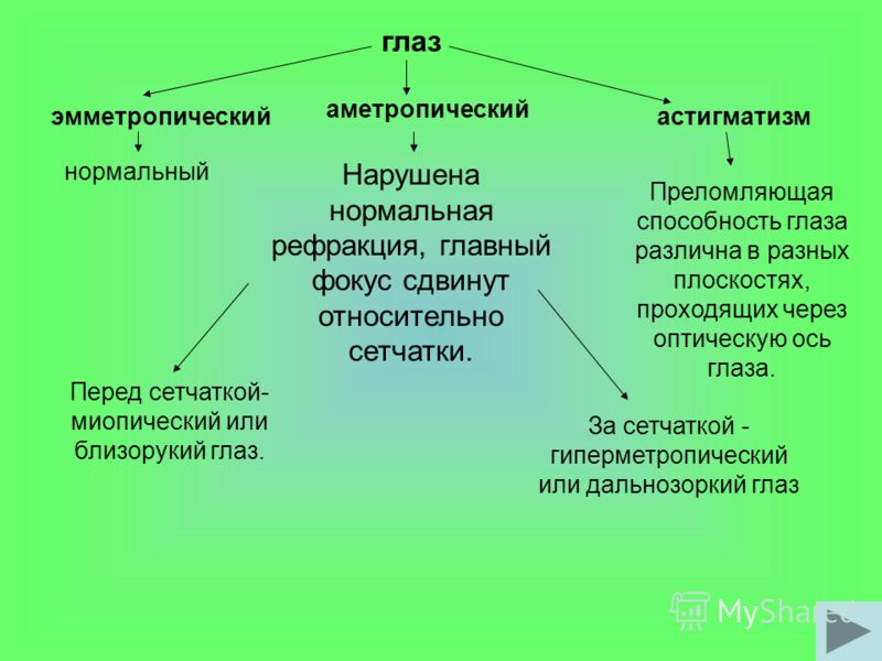 Дефект глаза при близорукости