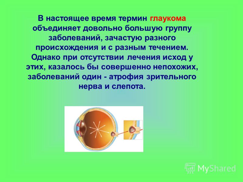 Причина близорукость и дальнозоркость и астигматизм