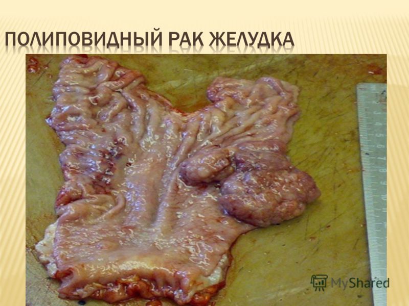 желудочный запах изо рта причины и лечение желудочный запах изо рта причины и лечение