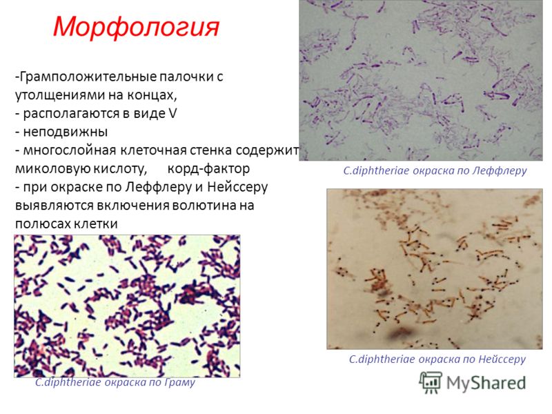 Морфология C.diphtheriae окраска по Леффлеру -Грамположительные палочки с утолщениями на концах, - располагаются в виде V - неподвижны - многослойная клеточная стенка содержит миколовую кислоту, корд-фактор - при окраске по Леффлеру и Нейссеру выявля