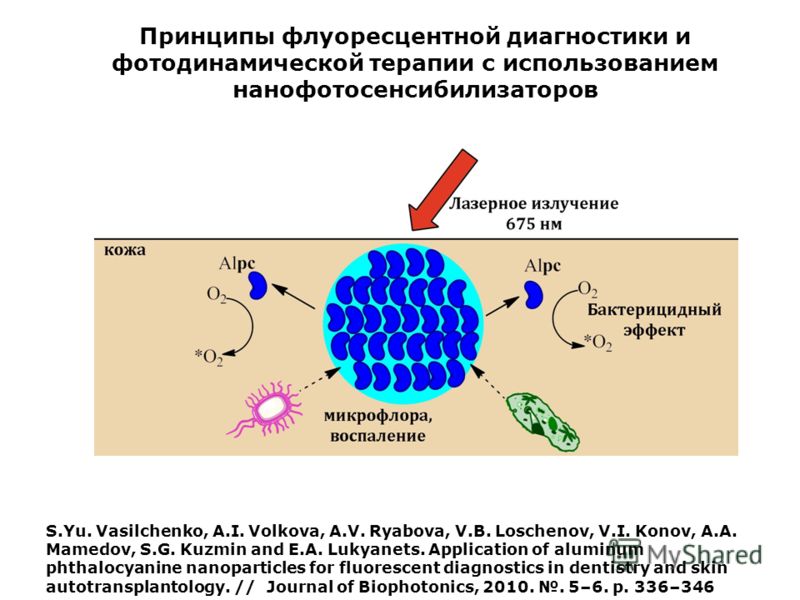S.Yu. Vasilchenko, A.I. Volkova, A.V. Ryabova, V.B. Loschenov, V.I. Konov, A.A. Mamedov, S.G. Kuzmin and E.A. Lukyanets. Application of aluminum phthalocyanine nanoparticles for fluorescent diagnostics in dentistry and skin autotransplantology. // Jo