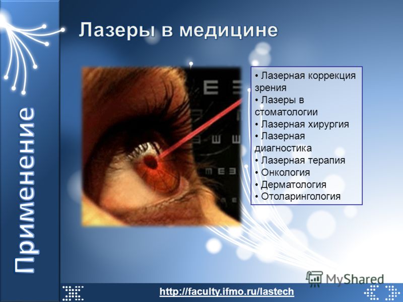 Заболел после лазерной коррекции зрения Заболел после лазерной коррекции зрения