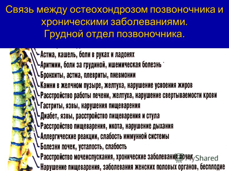 Болит грудной и поясничный отдел позвоночника Болит грудной и поясничный отдел позвоночника
