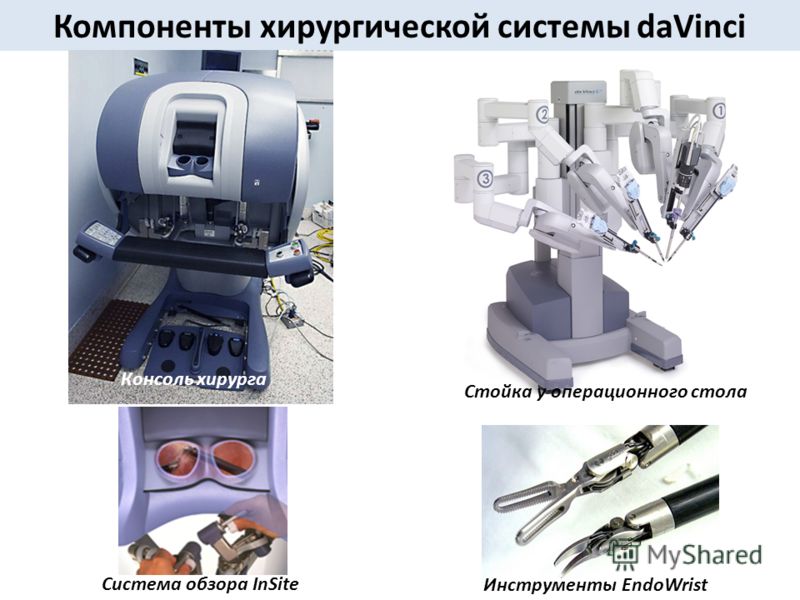 Реферат: Применение робототехники в хирургии. Преимущества и недостатки системы Да Винчи