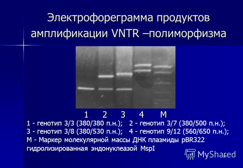 23 Электрофореграмма продуктов амплификации VNTR –полиморфизма 1 2 3 4 М 1 - генотип 3/3 (380/380 п.н.); 2 - генотип 3/7 (380/500 п.н.); 3 - генотип 3/8 (380/530 п.н.); 4 - генотип 9/12 (560/650 п.н.); M - Маркер молекулярной массы ДНК плазмиды pBR32