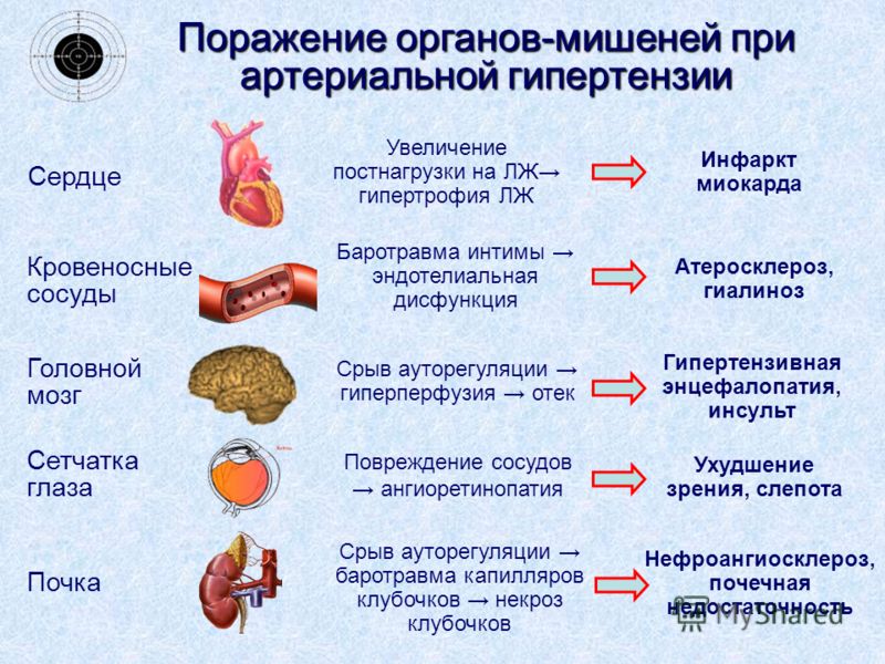 Диссертация по артериальной гипертензии