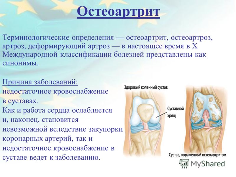 презентация на тему стежеви черви паразиты людей презентация на тему стежеви черви паразиты людей