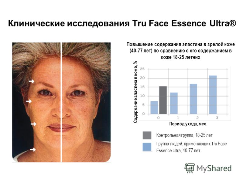 Клинические исследования Tru Face Essence Ultra® Содержание эластина в коже, % Повышение содержания эластина в зрелой коже (40-77 лет) по сравнению с его содержанием в коже 18-25 летних Период ухода, мес. Контрольная группа, 18-25 лет Группа людей, п