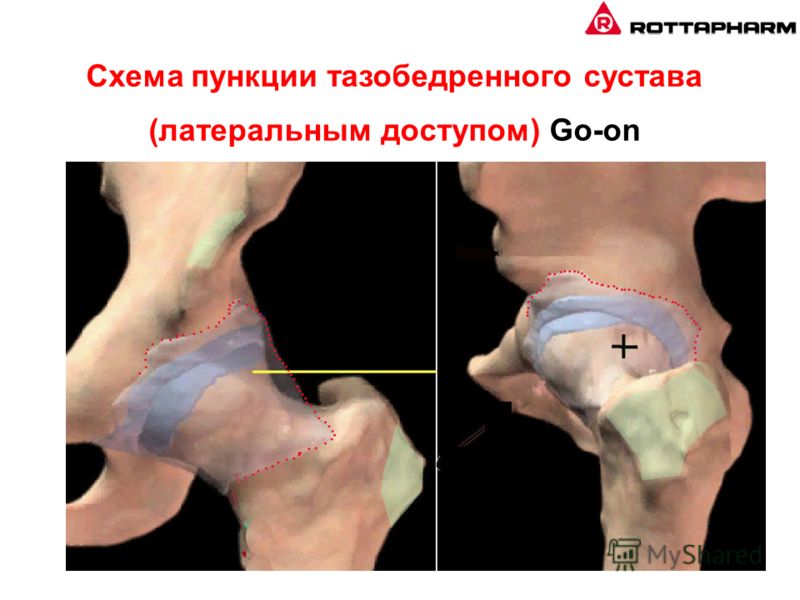Боль в ребрах, под ребрами » spine.com Боли при простатите: где и как болит?