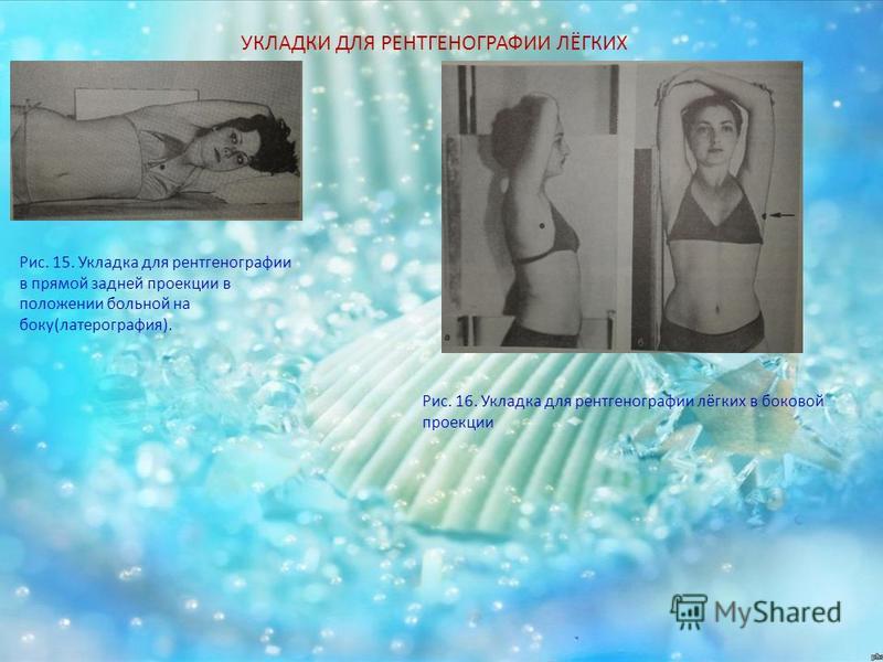 Укладка больных для рентгенографии Укладка больных для рентгенографии