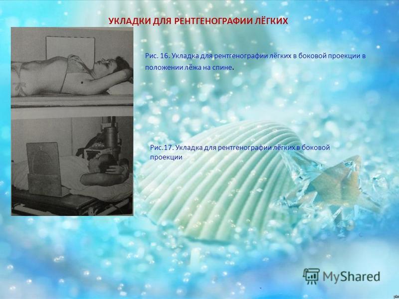 Укладка при рентгене легких Укладка при рентгене легких