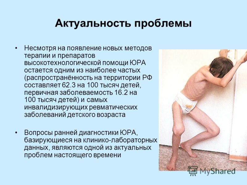 Крестцовый отдел у грудных детей