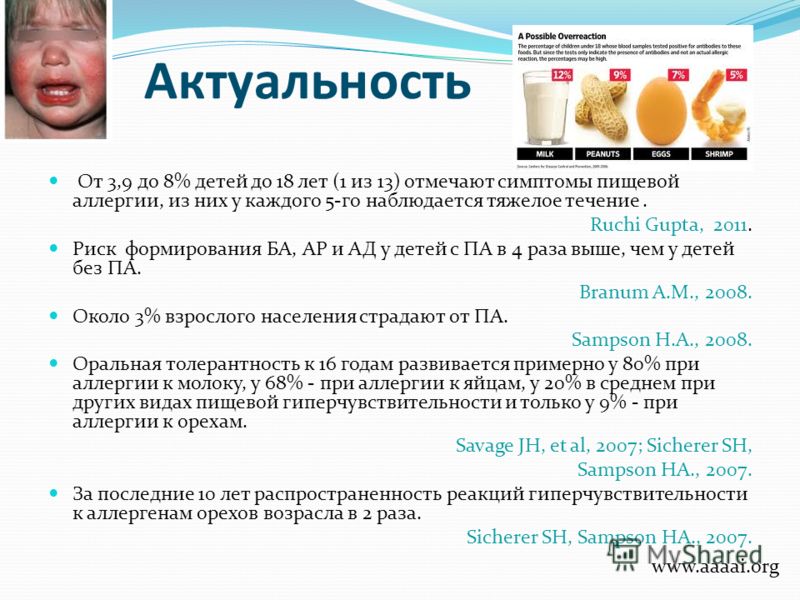 Актуальность От 3,9 до 8% детей до 18 лет (1 из 13) отмечают симптомы пищевой аллергии, из них у каждого 5-го наблюдается тяжелое течение. Ruchi Gupta
