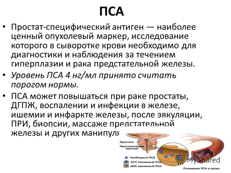 Видео пальцем массаж простаты порно