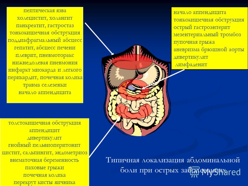 Пиелонефрит правосторонний при беременности