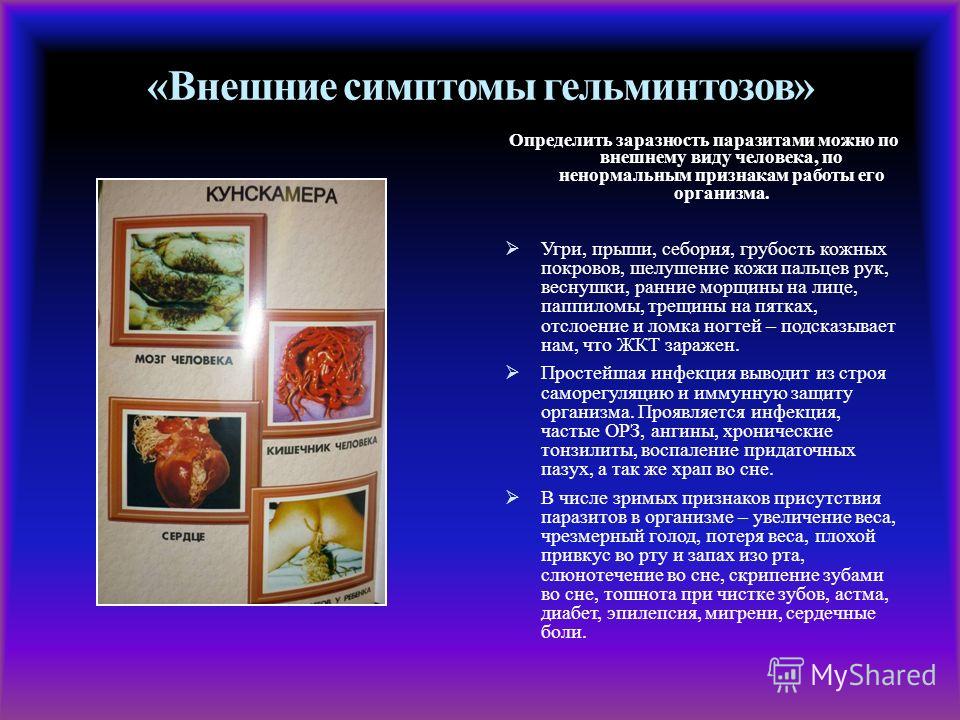 запах фекалий изо рта запах фекалий изо рта