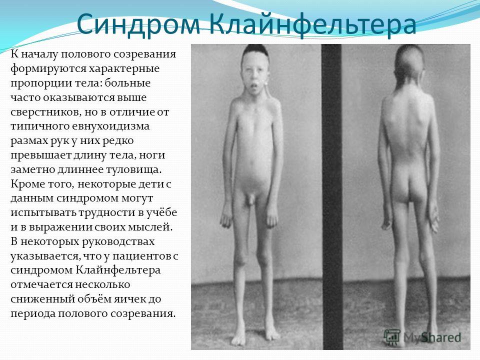 симптомы наличия паразитов в организме человека лечение симптомы наличия паразитов в организме человека лечение