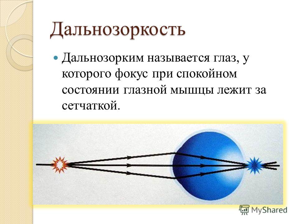 Коррекция зрения тверь цена