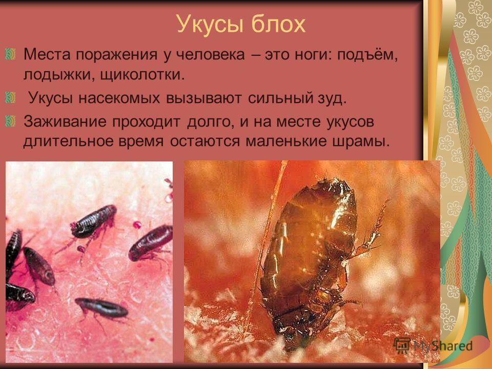 блохи у человека блохи у человека
