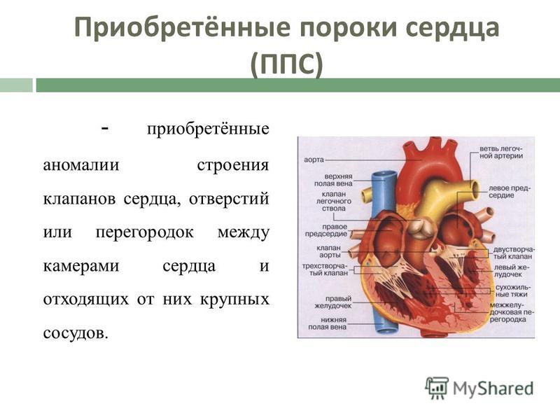 Реферат по теме Терапия (пороки сердца) Реферат по теме Терапия (пороки сердца)