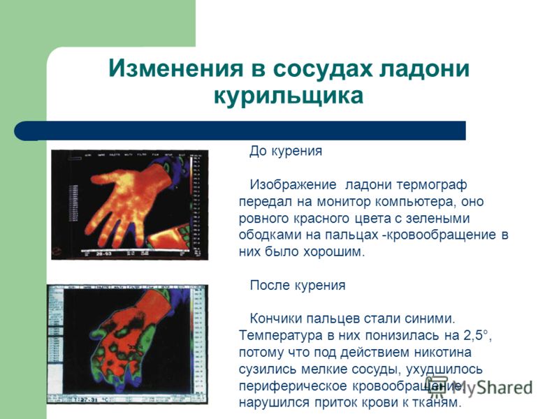 Перешить сидения минск Перешить сидения минск