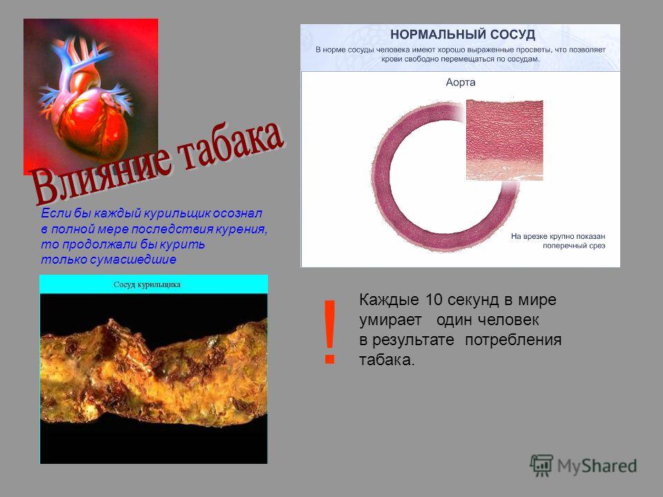 Если бы каждый курильщик осознал в полной мере последствия курения, то продолжали бы курить только сумасшедшие Каждые 10 секунд в мире умирает один че