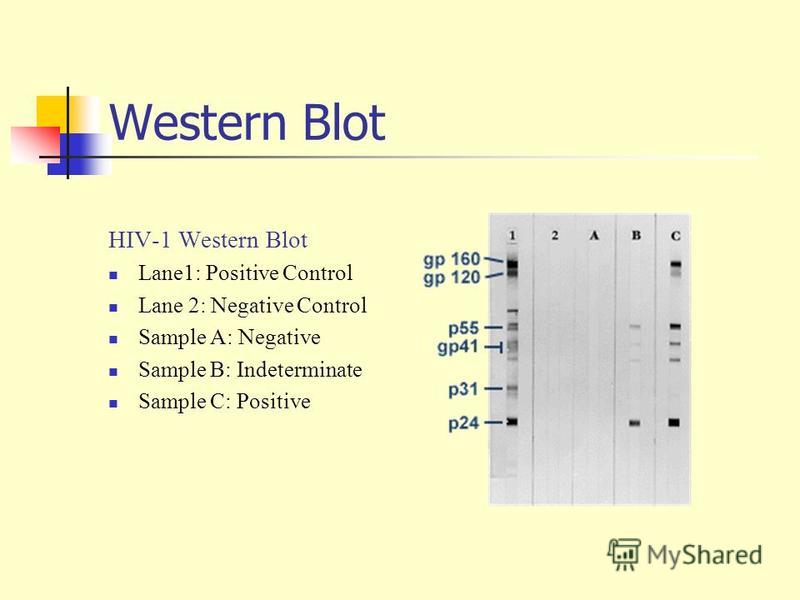 western blot test for hiv western blot test for hiv