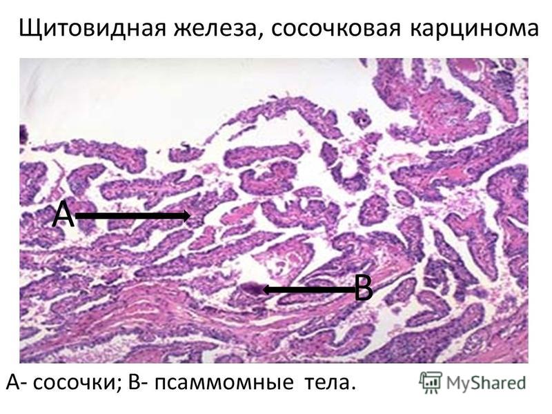 После бега болят кости голени что После бега болят кости голени что