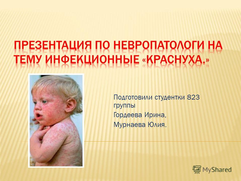 краснуха без сыпи