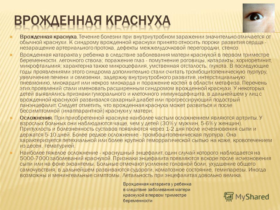 Врожденная краснуха. Течение болезни при внутриутробном заражении значительно отличается от обычной краснухи. К синдрому врожденной краснухи принято о