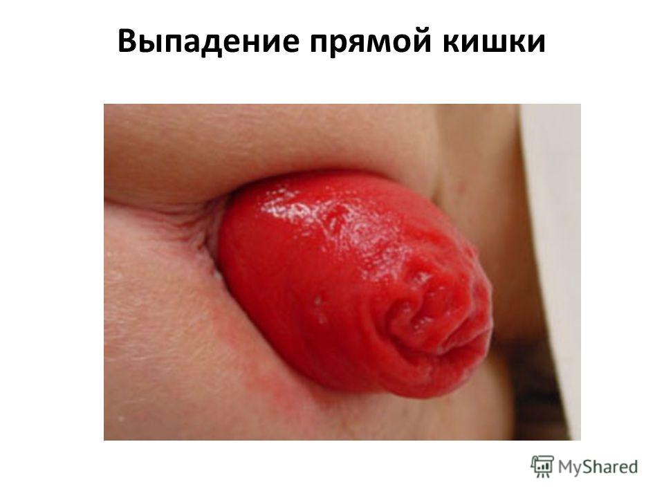 основы питание для похудения основы питание для похудения