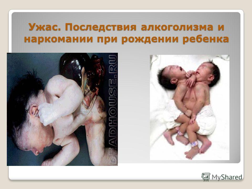 Лекарственные препараты для лечения зависимость от алкоголизма