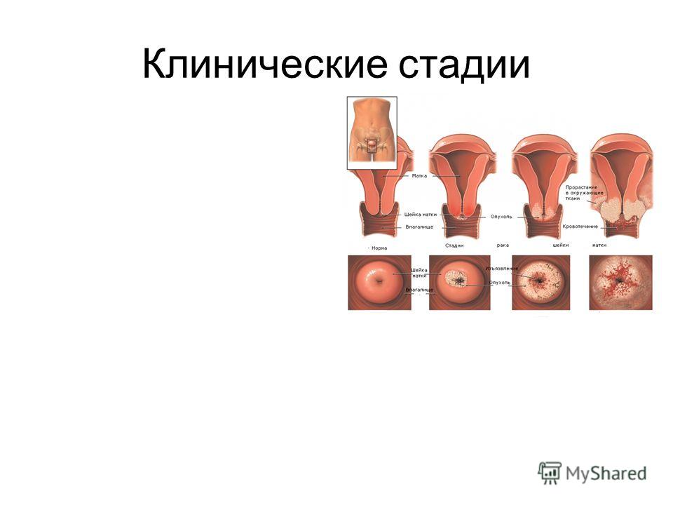 Презентация На Тему Рак Животное Презентация На Тему Рак Животное