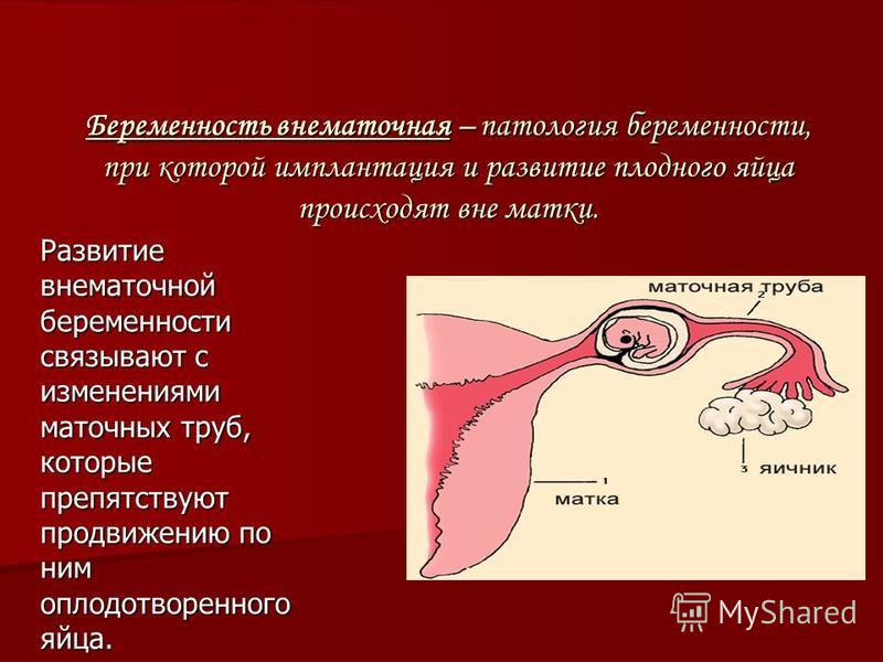 Ребенок рисует черным цветом: что это значит по мнению психолога Призвание врач - Сибирский медицинский портал