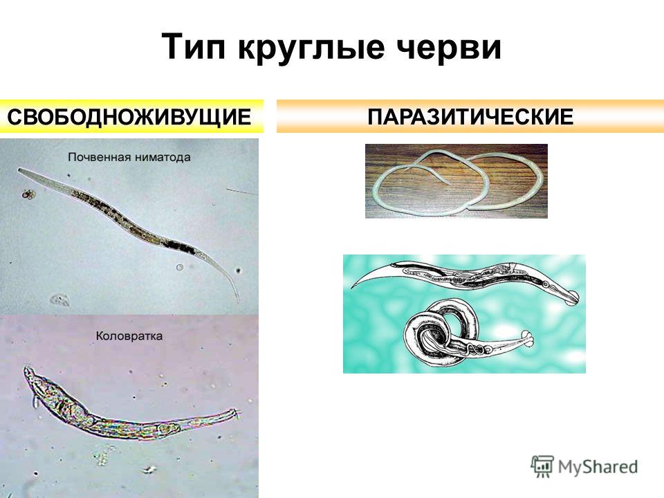 Тип круглые черви ПАРАЗИТИЧЕСКИЕ СВОБОДНОЖИВУЩИЕ