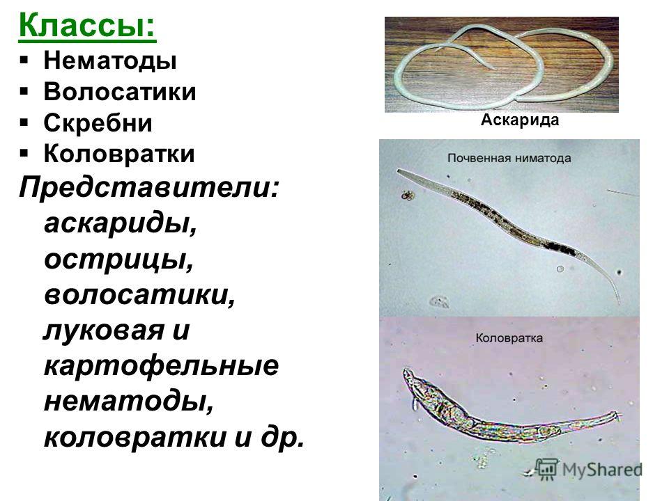 Классы: Нематоды Волосатики Скребни Коловратки Представители: аскариды, острицы, волосатики, луковая и картофельные нематоды, коловратки и др. Аскарид