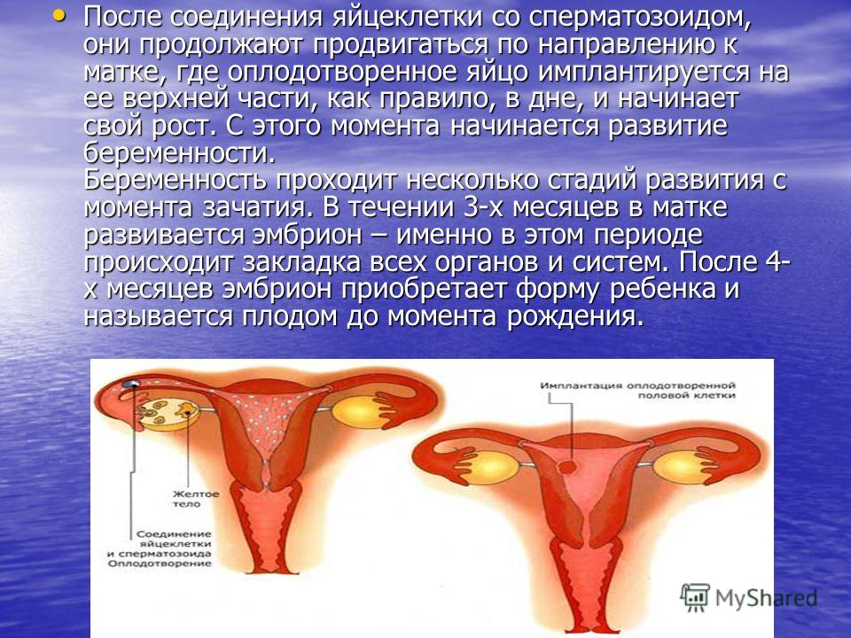 Можно ли забеременеть с полипом в матке