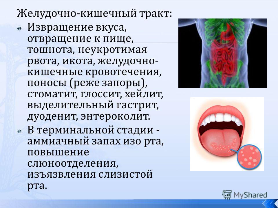 аммиачный запах изо рта аммиачный запах изо рта