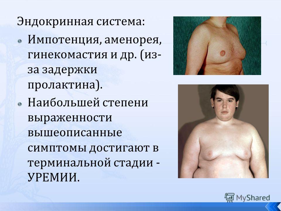 аммиачный запах изо рта аммиачный запах изо рта