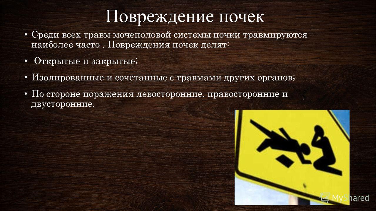 photo Дистопия почки изображения photo Дистопия почки изображения