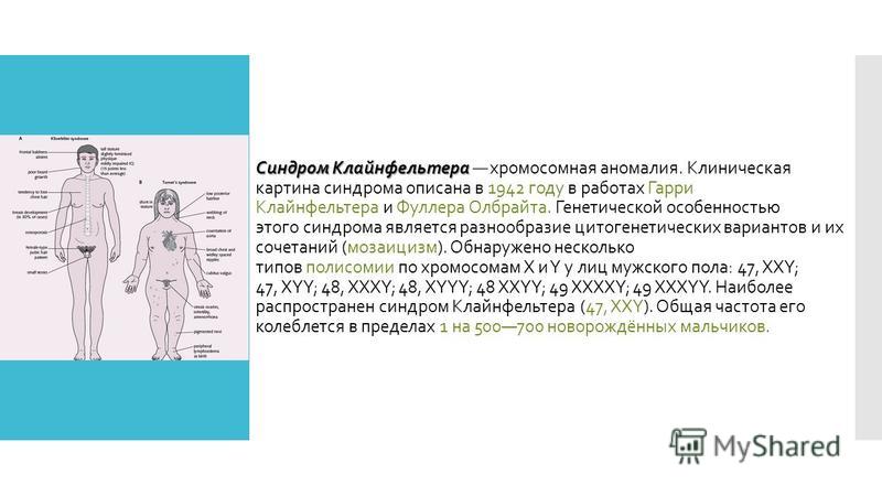 Синдром клайнфельтера презентация