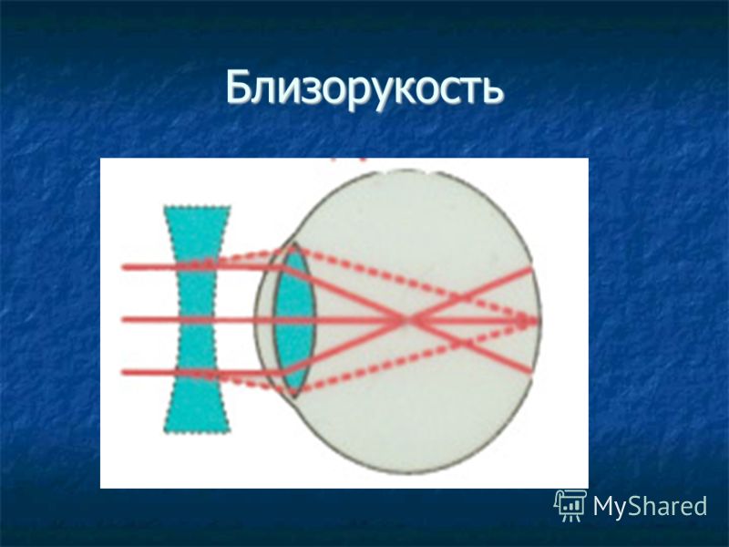 Клиника по восстановлению зрения иркутск
